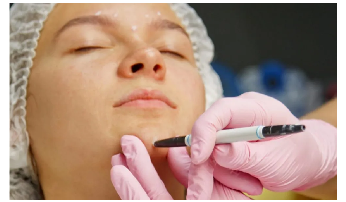 Kybella at Young & Radiant: Non-Invasive Double Chin & Fat Reduction in Sunrise, FL